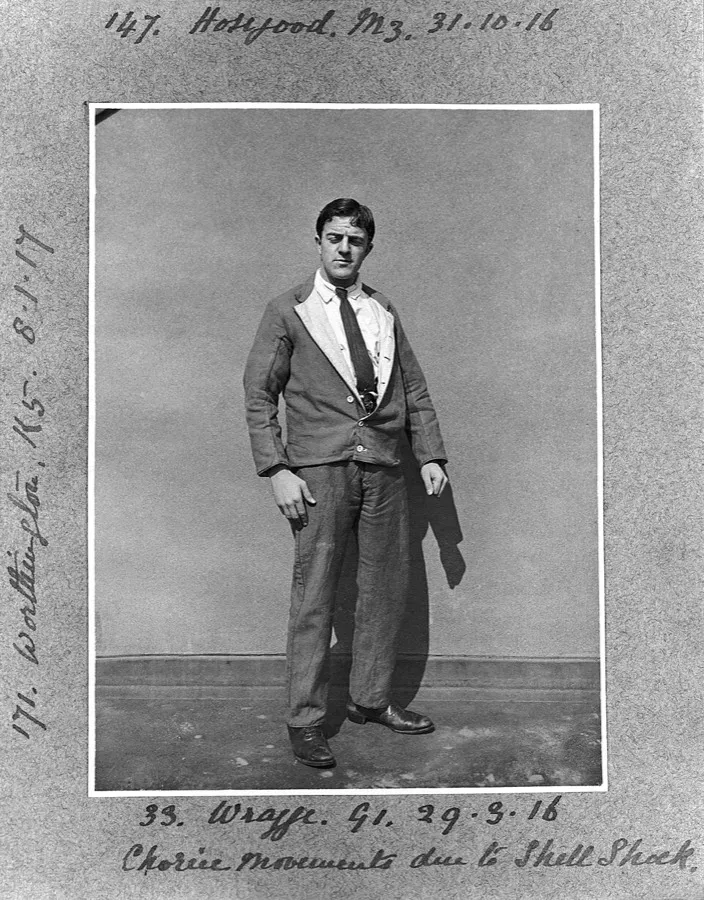 Chronic movements due to shell shock, (1916) Photograph no.